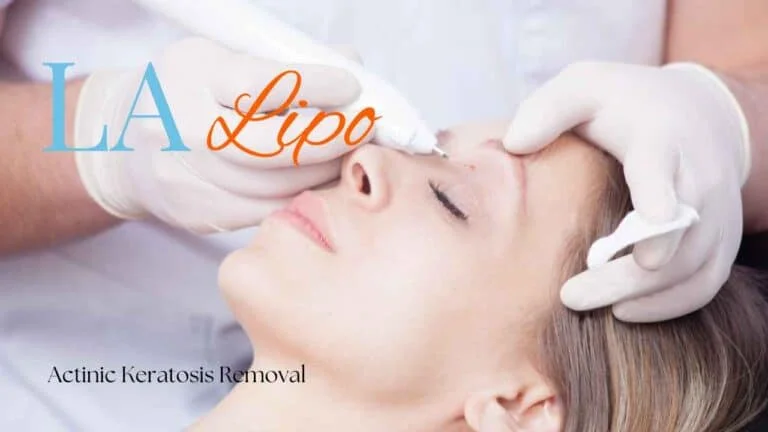 Woman receiving Actinic Keratosis Removal Treatment Godmanchester