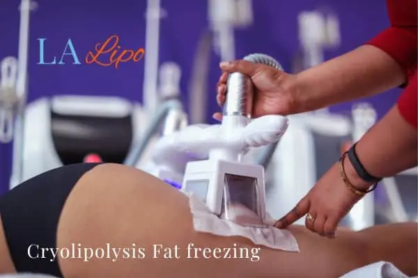 women getting fat freezing Godmanchester