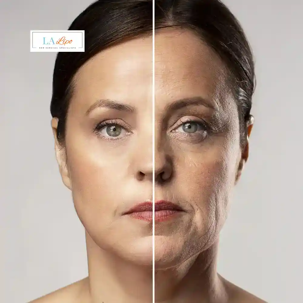 How Can You Tell If Non-Surgical Skin Tightening Is Right for You Godmanchester?