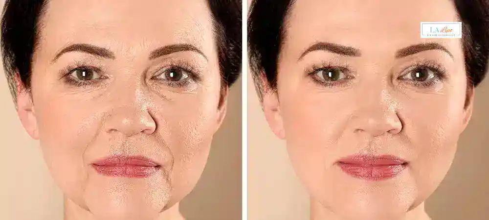Why Aren’t My Skincare Products Making My Sagging Skin Look Firmer Godmanchester?