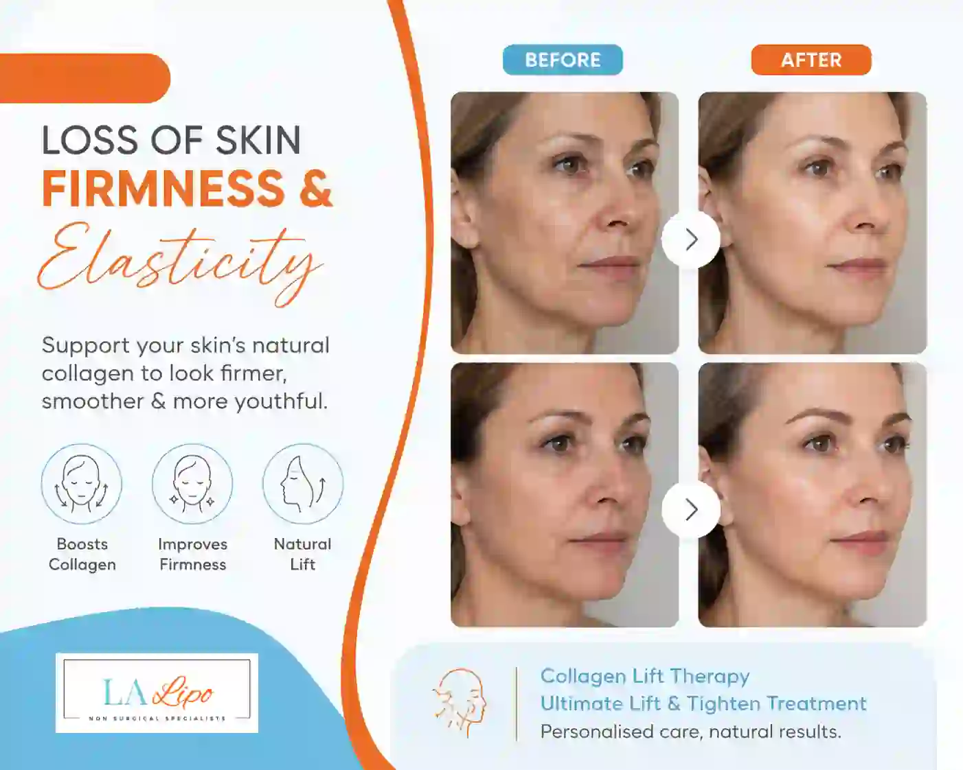 Sign #7: Loss of Skin Firmness and Elasticity Godmanchester